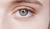 Blepharoplasty