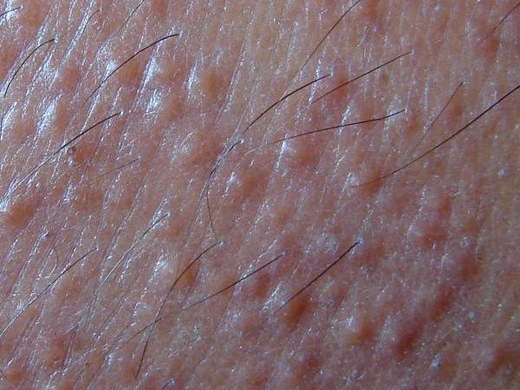 Rashes clinical photo