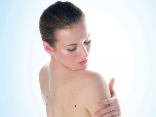 Skin Cancer Detection clinical photo