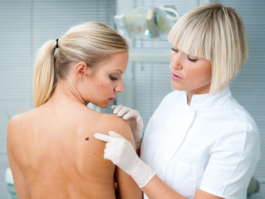Skin Cancer Detection clinical photo